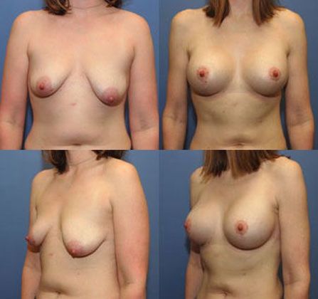 Case 099
